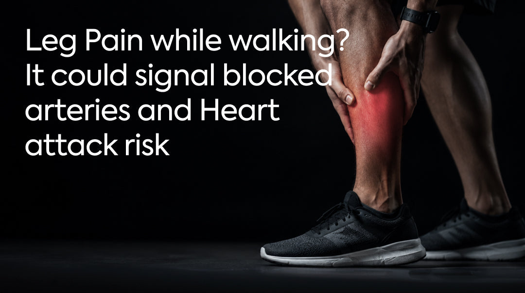 Leg Pain While Walking? It Could Signal Blocked Arteries and Heart Attack Risk