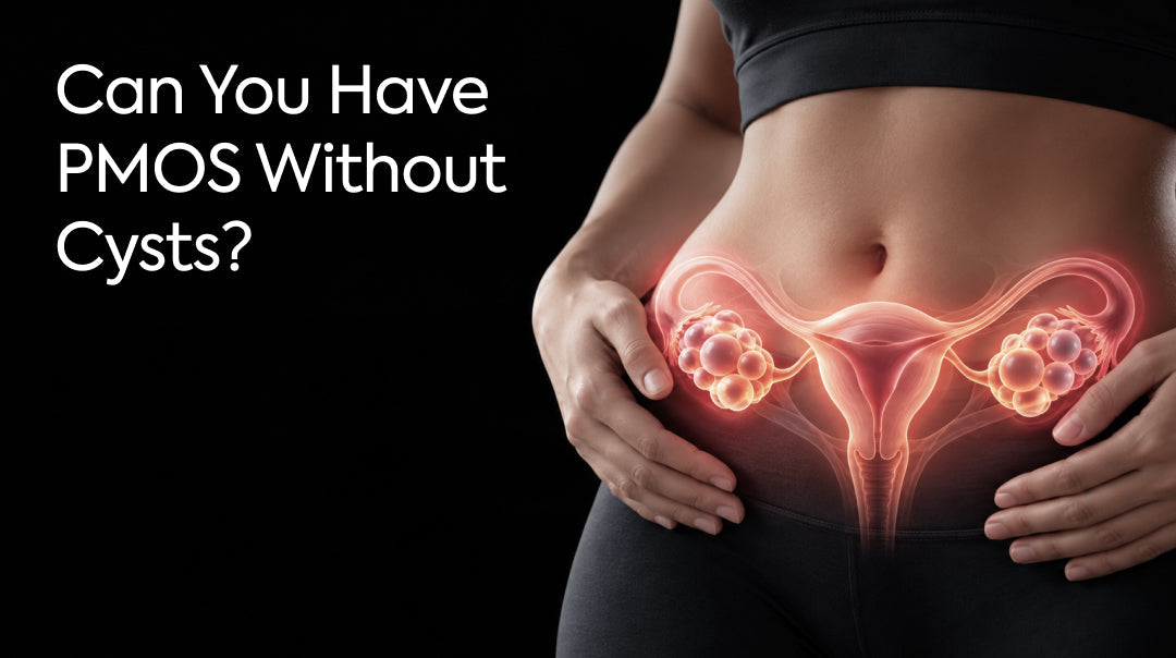 Can You Have PMOS Without Cysts? Understanding the Condition
