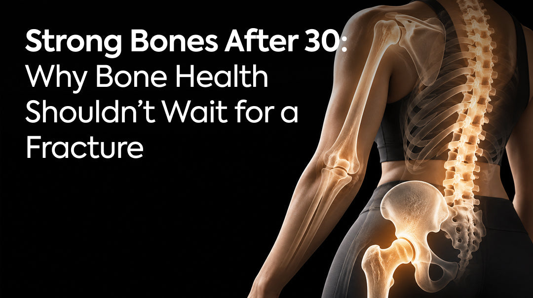 Strong Bones After 30: Why Bone Health Shouldn’t Wait for a Fracture