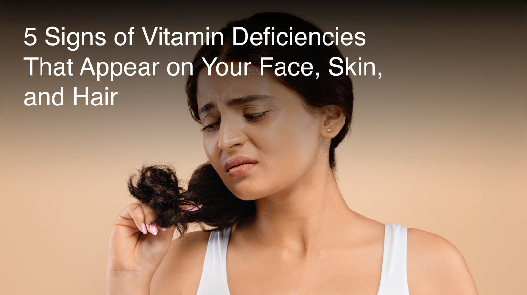 5 Signs of Vitamin Deficiencies That Appear on Your Face, Skin, and Hair